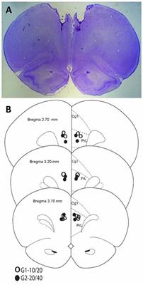 Inactivation of the Medial-Prefrontal Cortex Impairs Interval Timing Precision, but Not Timing Accuracy or Scalar Timing in a Peak-Interval Procedure in Rats